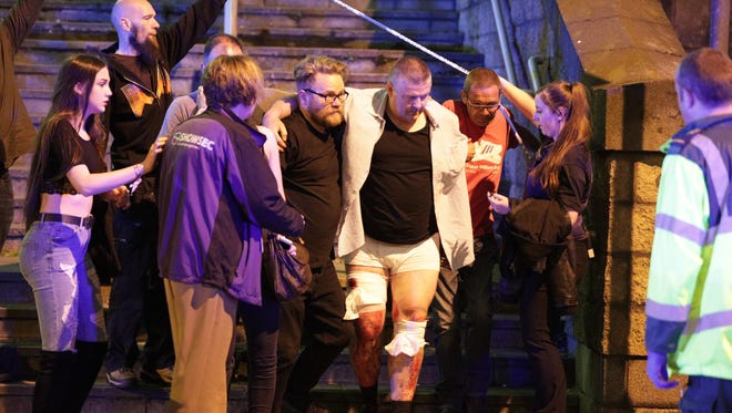 Injured are helped at the near the Manchester Arena after reports of an explosion. Police have confirmed they are responding to an incident during an Ariana Grande concert at the venue. Reported Explosion at Manchester Arena, UK - 22 May 2017